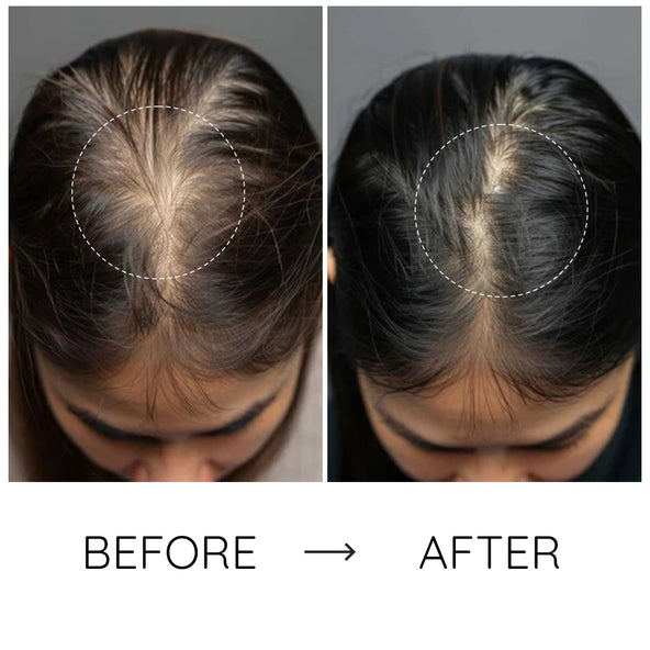 The gentle boost your hair deserves, healthier, shinier, and fuller.